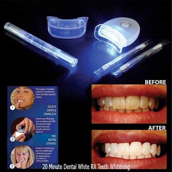 20-Minute-Dental-White-RX-Teeth-Whitening-4
